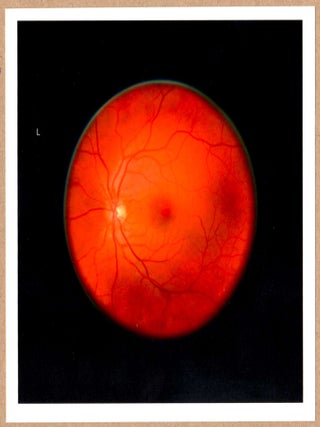 Item #4276 SIGNED - MIKHAEL SUBOTZKY - RETINAL SELF-PORTRAIT, LEFT EYE - LTD 6" x 6" MAGNUM...